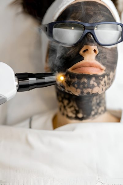 carbon laser carbon laser
