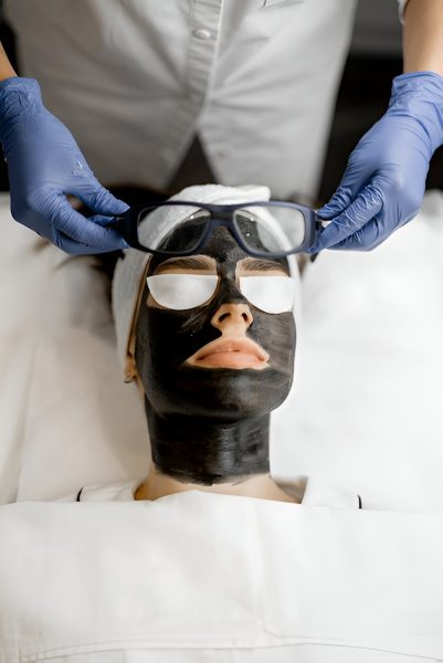 carbon peel carbon peel