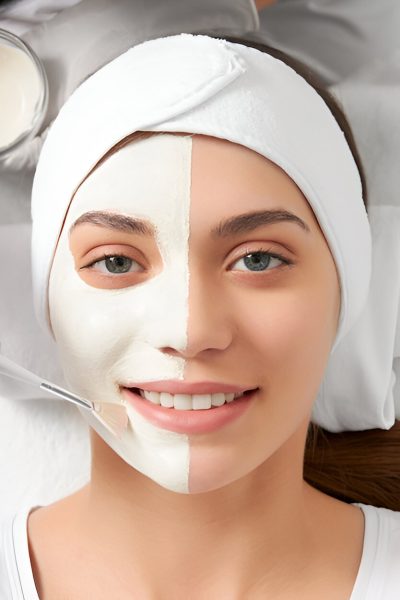 chemical Peel chemical Peel
